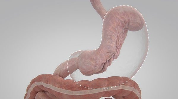 estomago reducido por la manga endoscopica