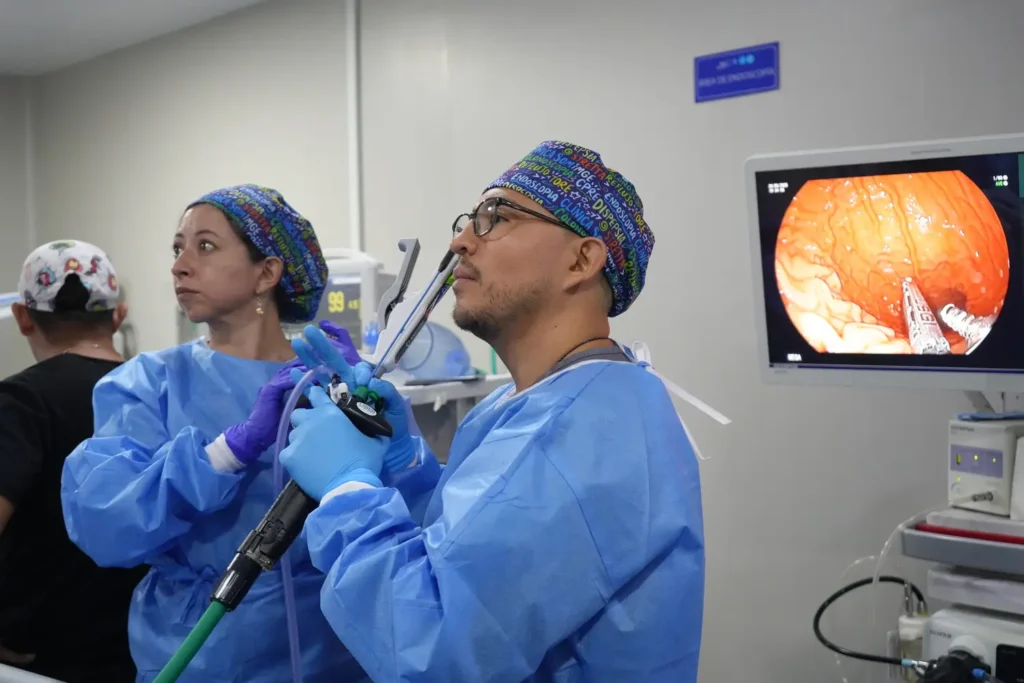 elegi si optas por Manga gástrica o manga endoscópica