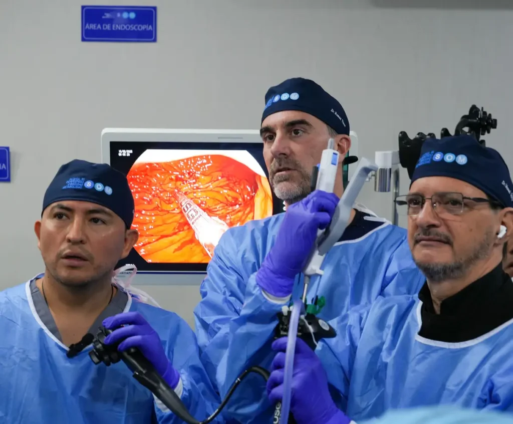 Manga gastrica endoscopica procedimiento no invasivo